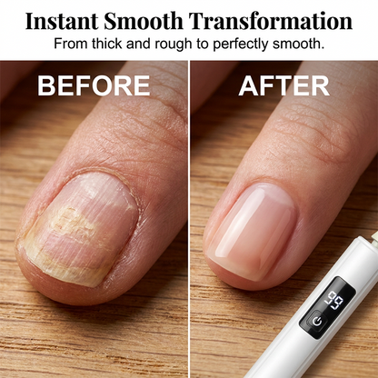 ⏰🔥SCONTO DEL 50% PER UN PERIODO LIMITATO!🔥OLTRE 50K+ VENDUTE!💅 Lucidautie elettrico professionale – unghie lucide e perfette in pochi secondi! ✨⚡